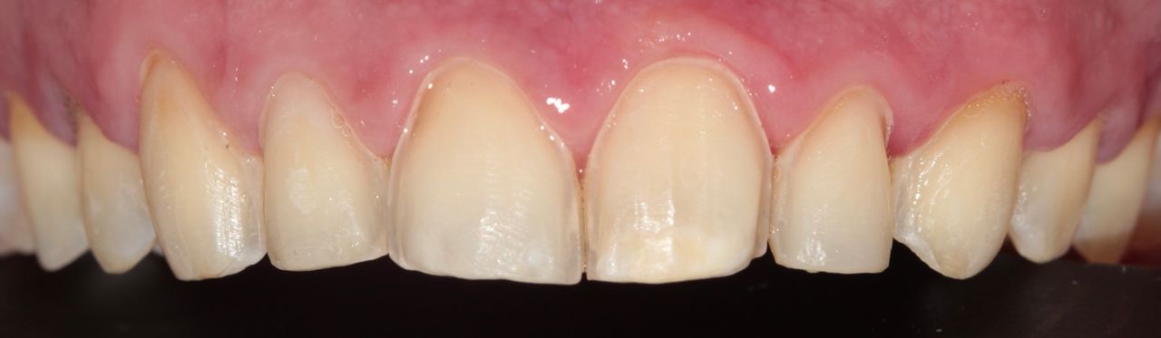 Emmanuel Pineda Herrera-2