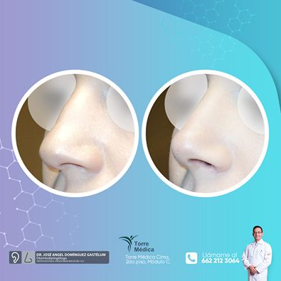 Jose Angel Dominguez Gastelum-10