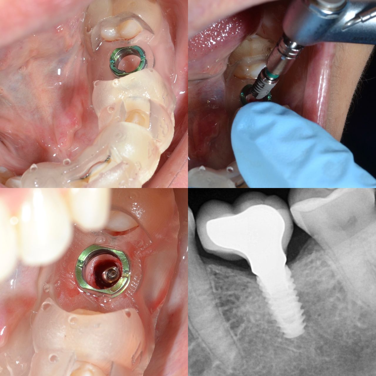 Francisco Jose Vives Serrano-20