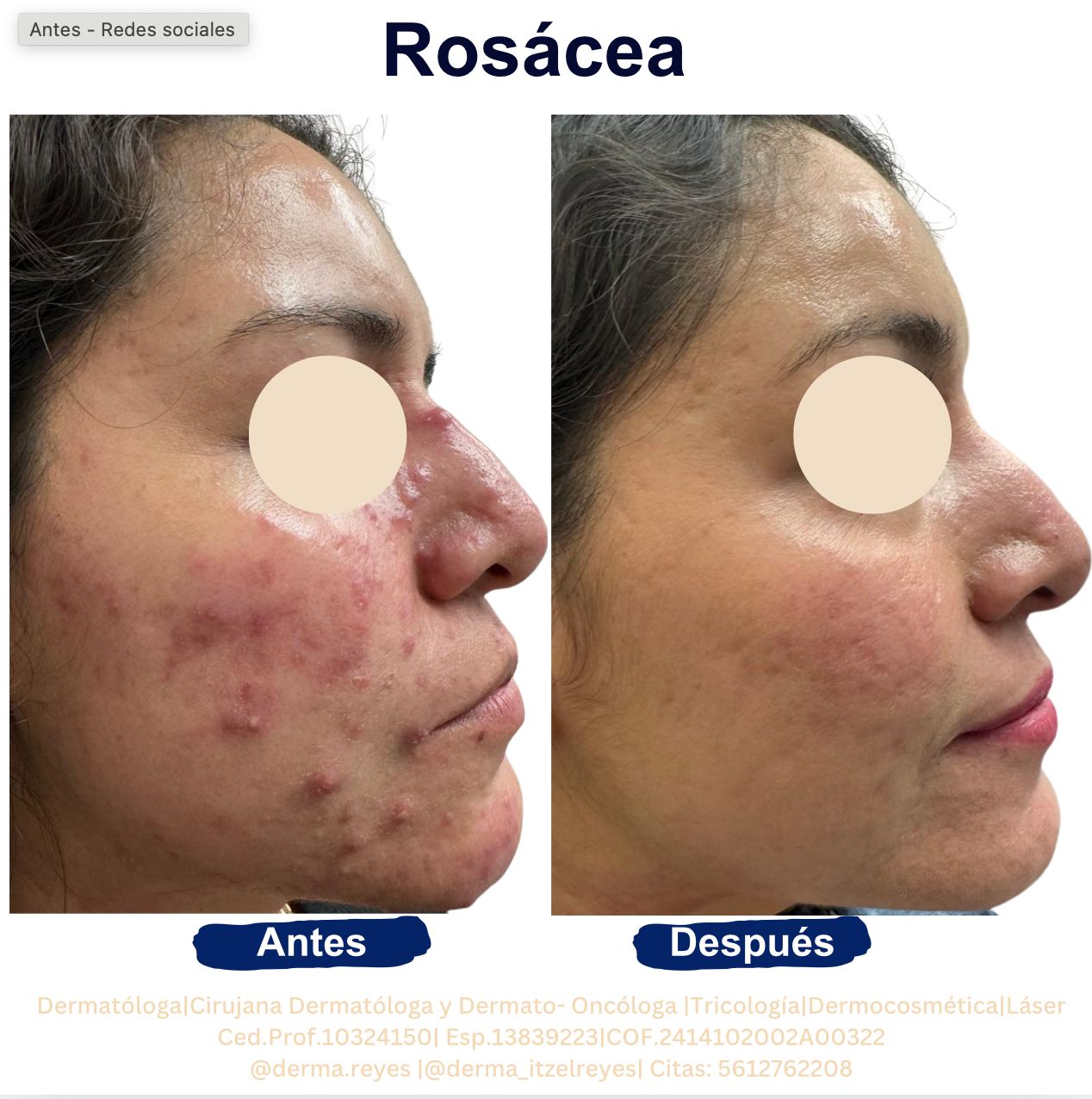 Itzel Anayn Flores Reyes-11