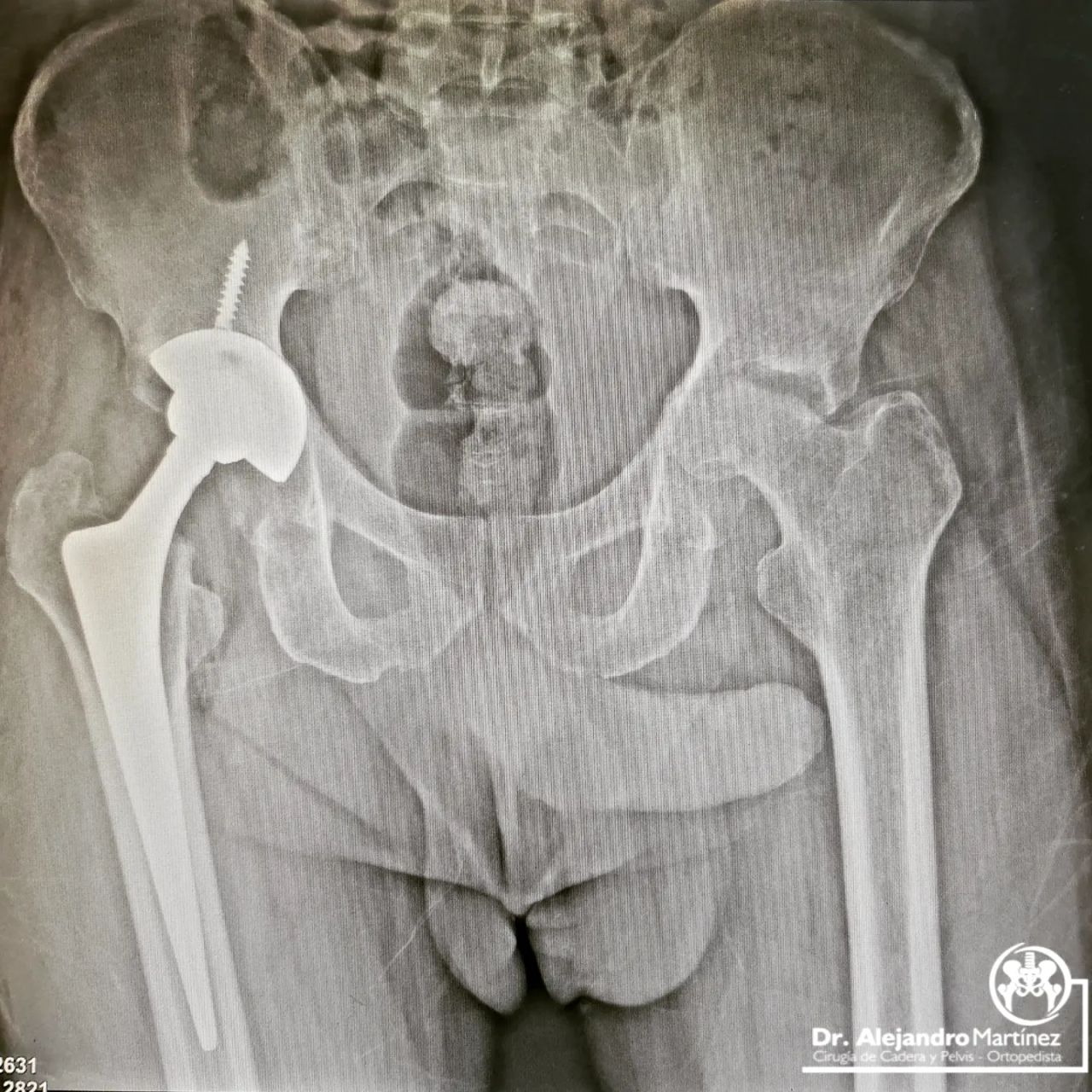 Alejandro Martínez Ramírez-8