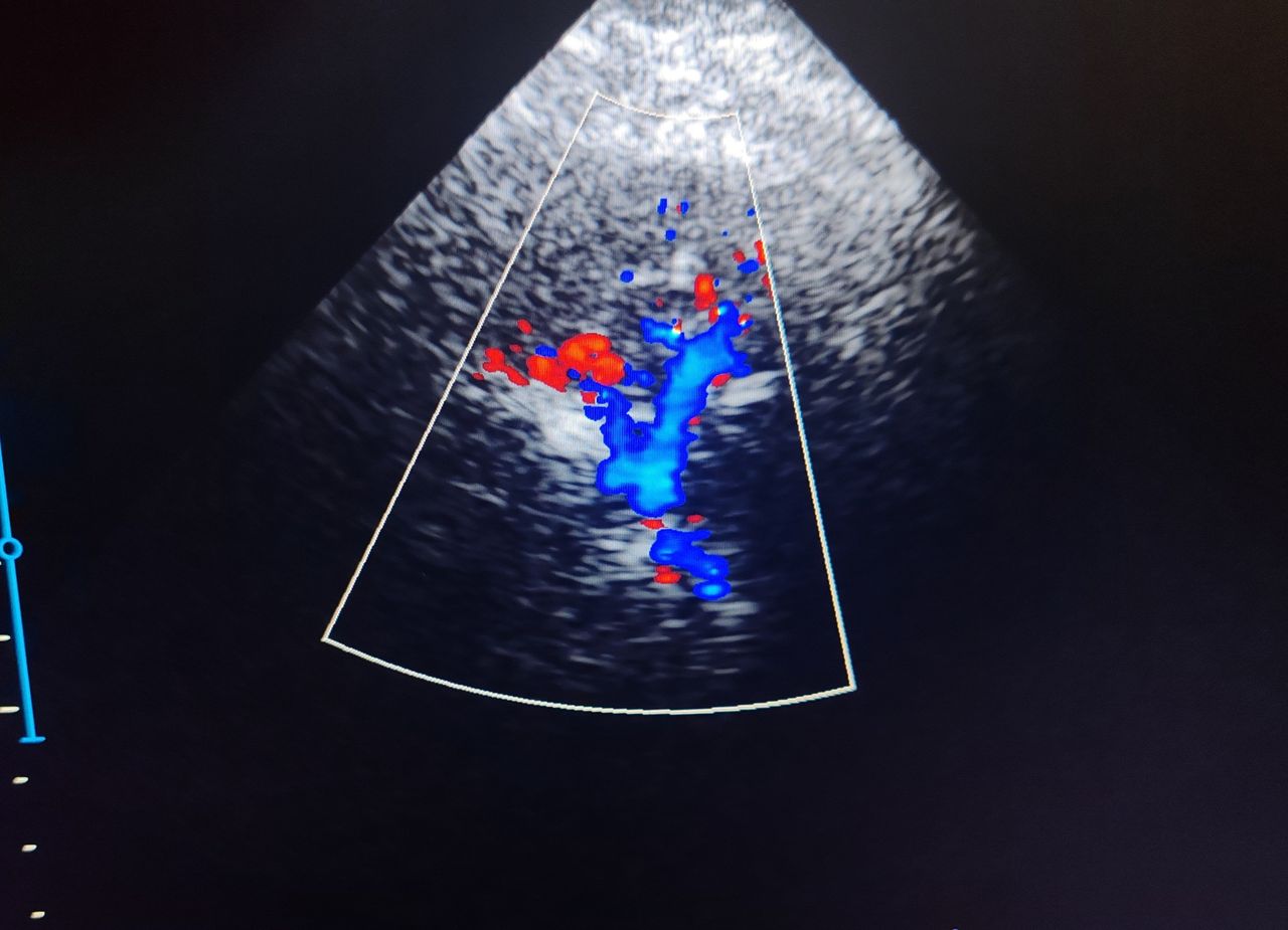 Omar Francisco Catana Gallegos-1