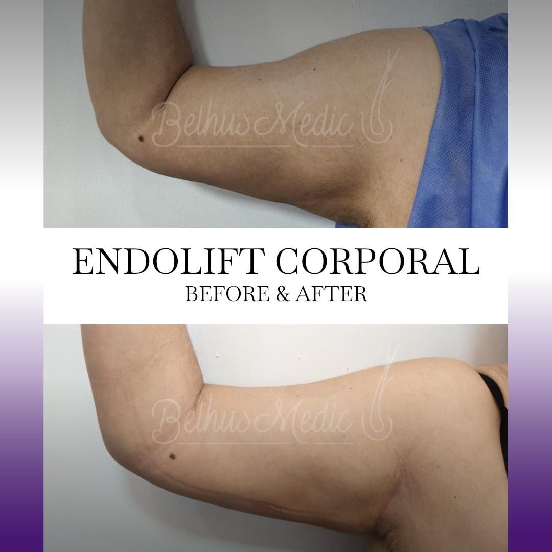 Alejandra Soriano Elorza-94