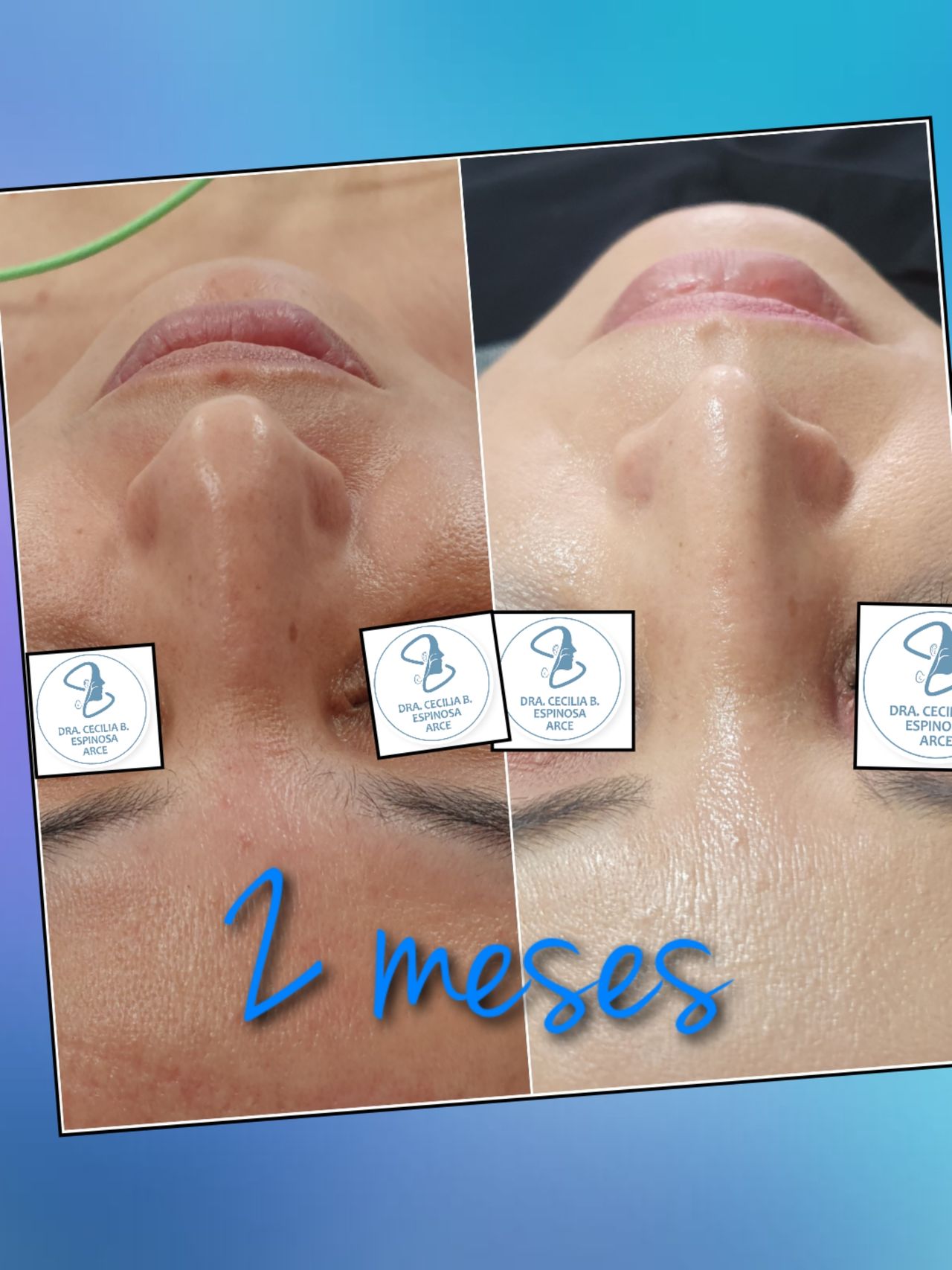 Cecilia Belen Espinosa Arce-30