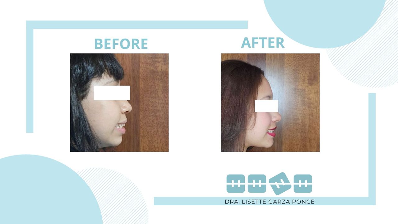 Lisette Garza Ponce-7