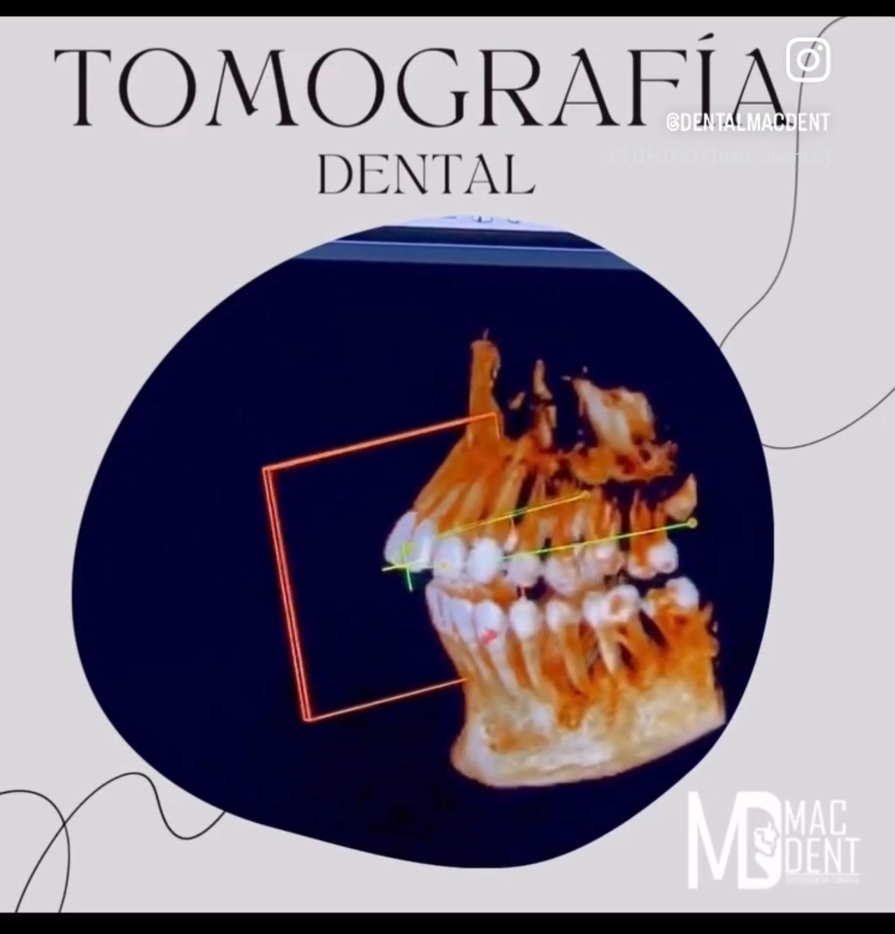 Miguel Ángel Cervantes Rodríguez-1