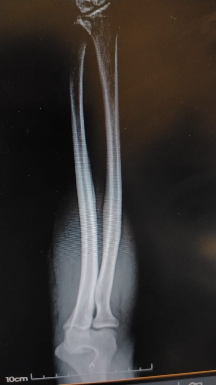 Alejandro Irisson-22