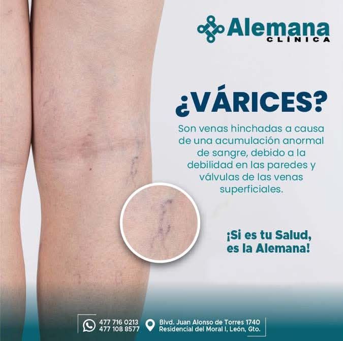 Anabel Salazar Reyes-2