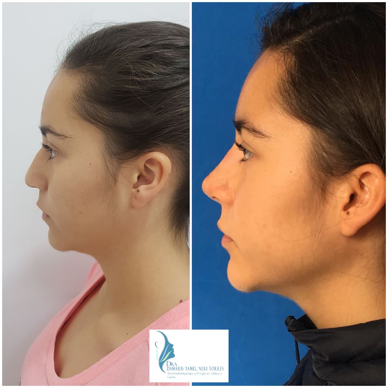 Damaris Yamel Neri Torres-6