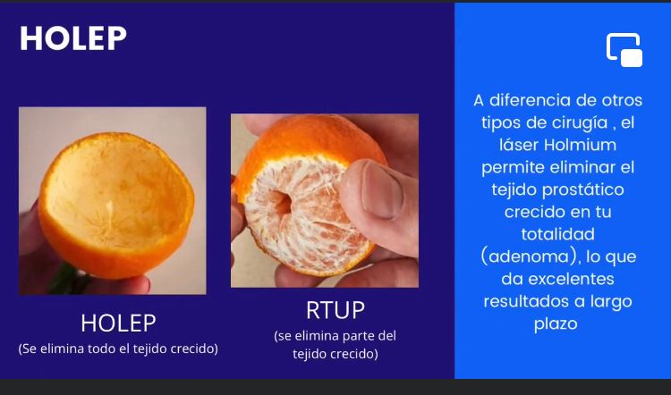 Irving Reyna Blanco-0