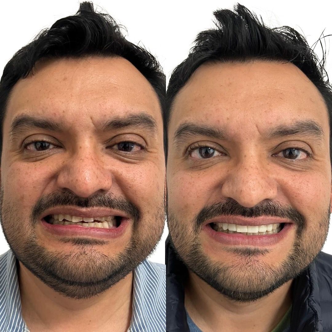 Ivan Torres Rascon-5