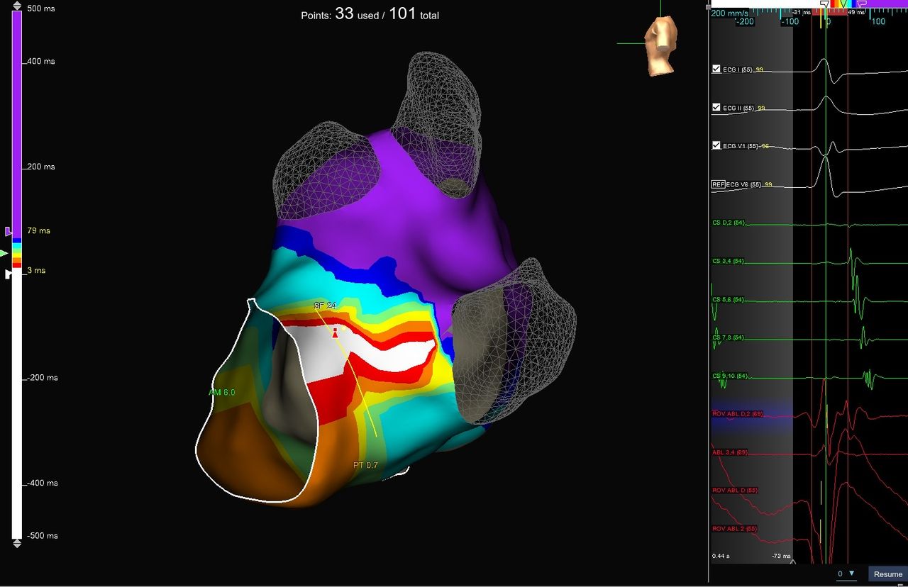 Elias Andrade Cuellar-1