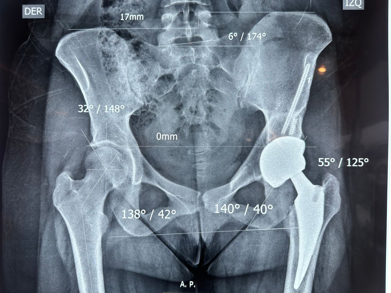 Alejandro Martínez Ramírez-37