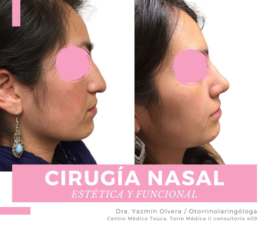 Ma. Yazmín Olvera Suárez-45