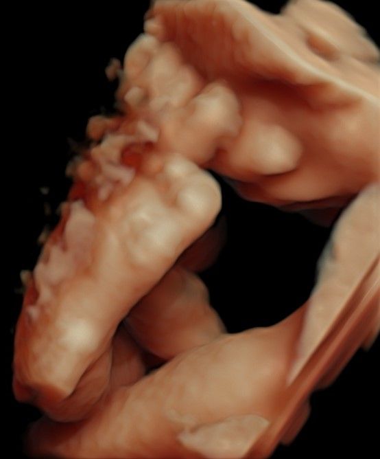 Nallely Moreno  Uribe-7