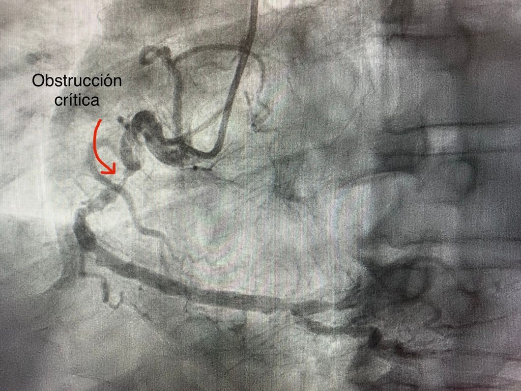 Juan René Cornejo Avendaño-21