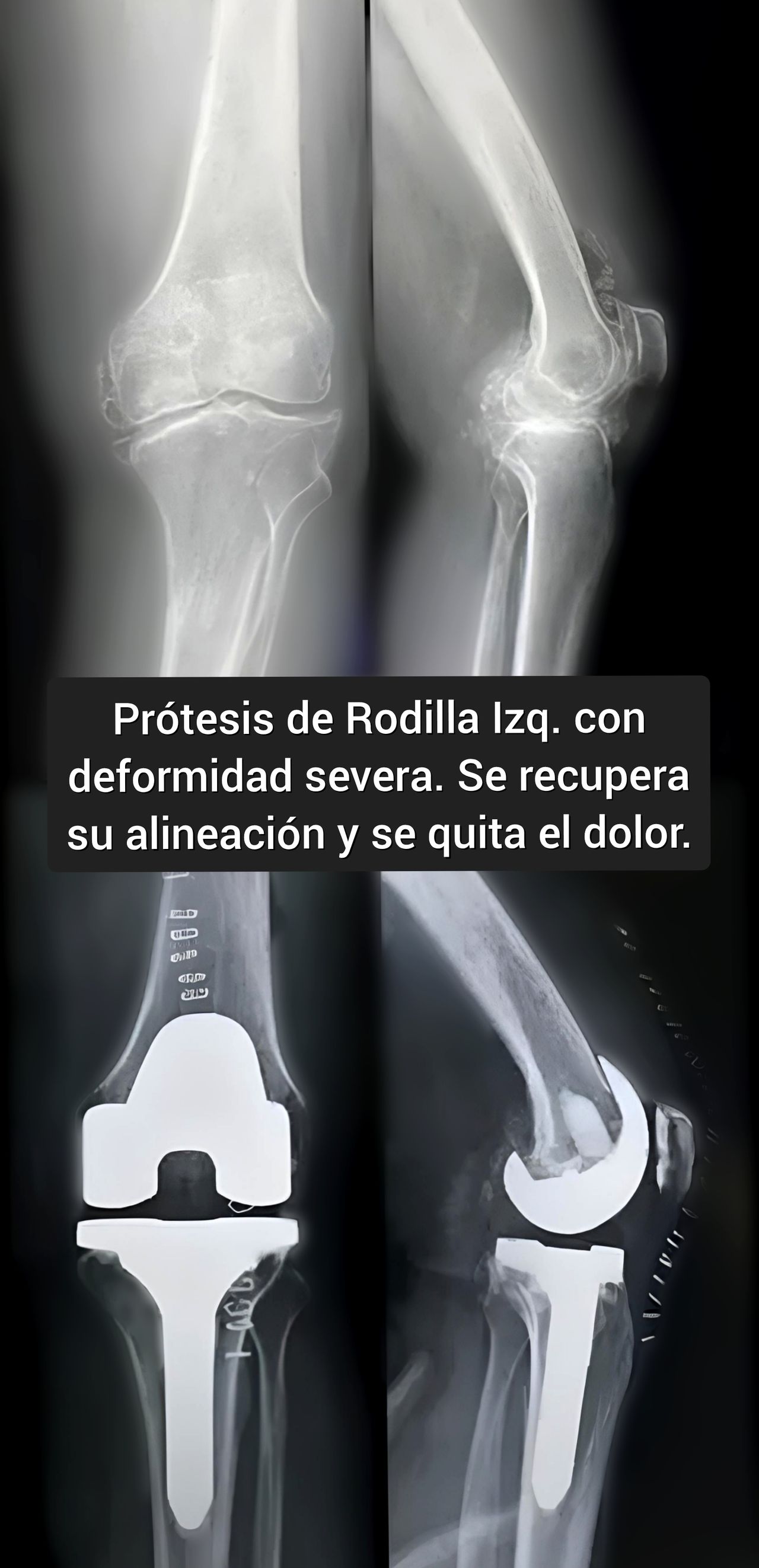 Noé Saavedra Islas-1