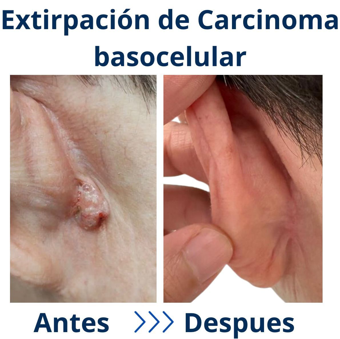 Itzel Anayn Flores Reyes-40