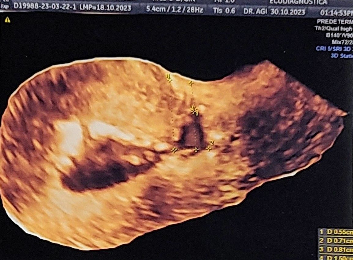 Luis Edmundo Hernández Vivar-6