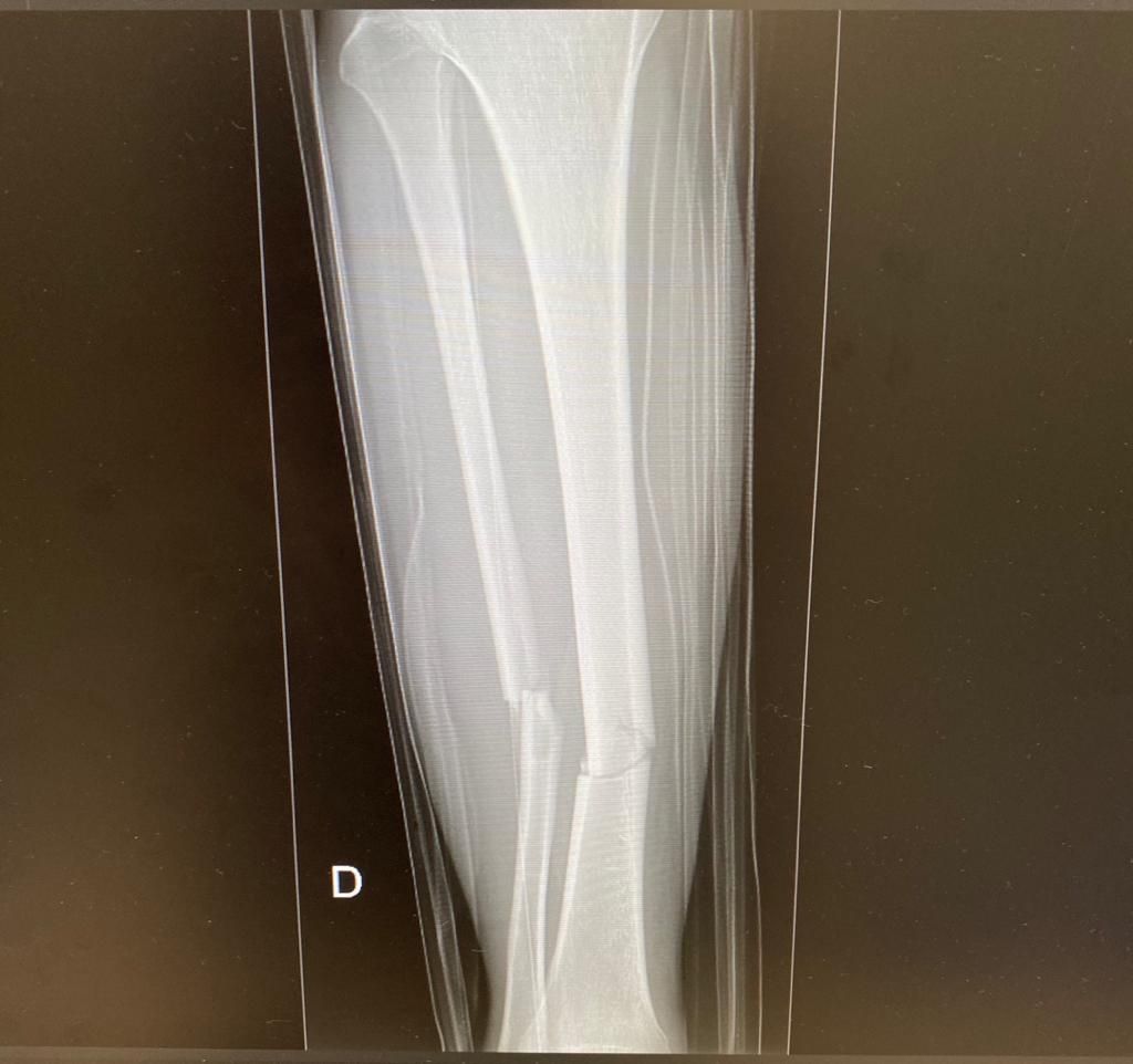 Jeftte Aaron Chacon Martinez-16