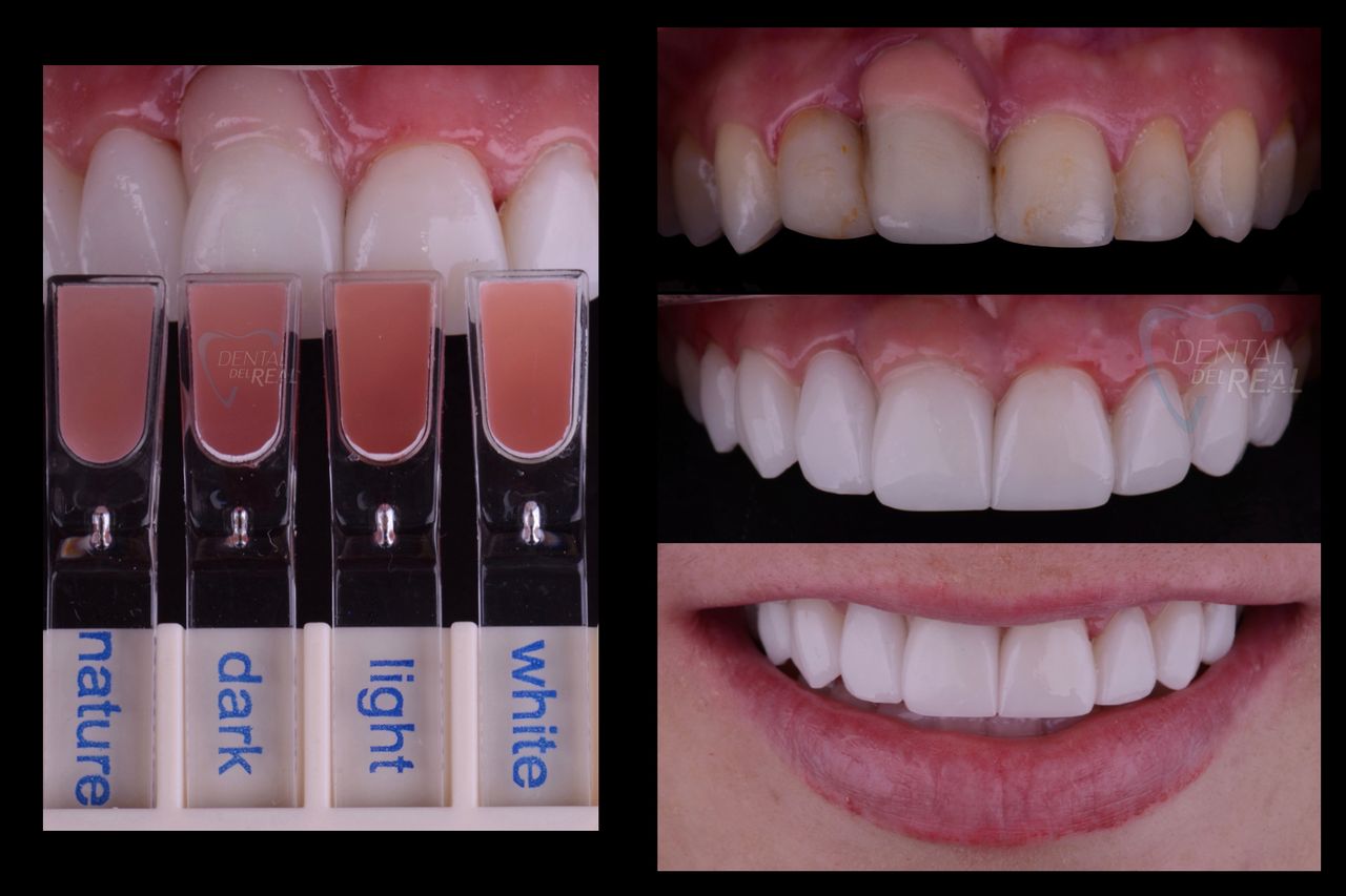 José Francisco Del Real García-75