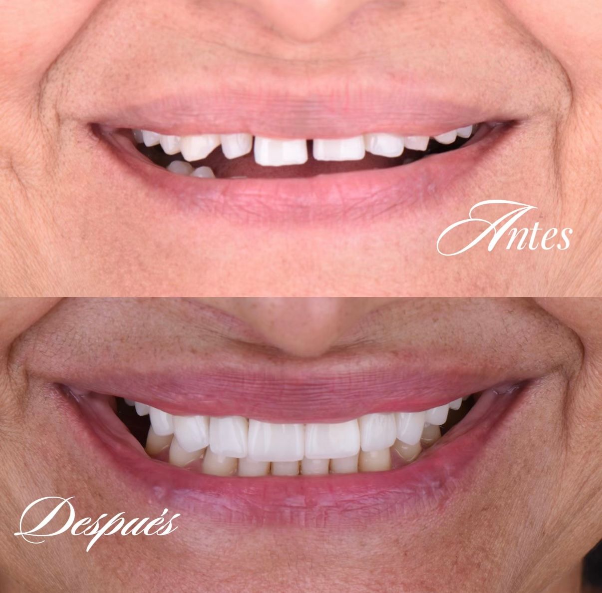 Irving Quezada Lara-13