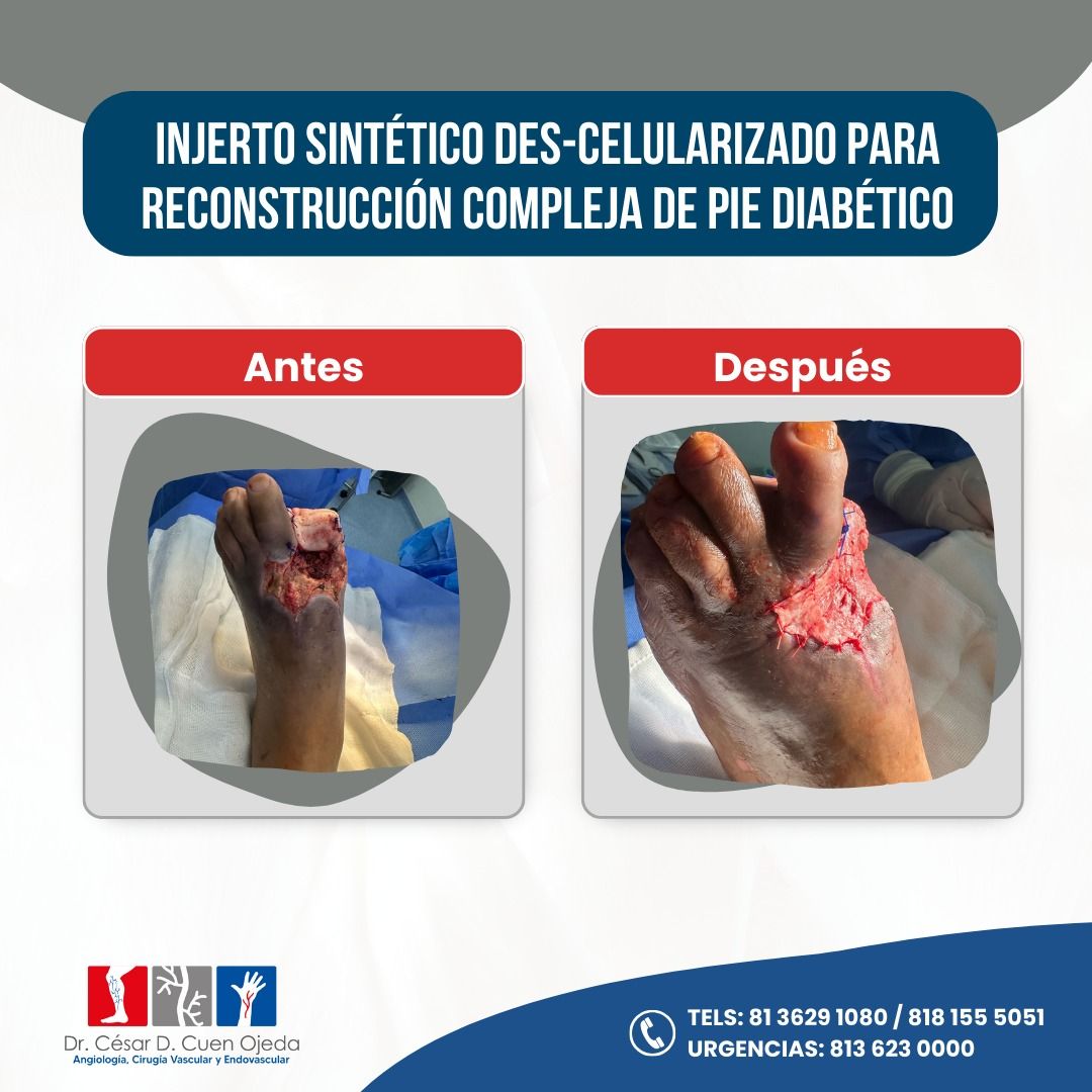 César Daniel Cuen Ojeda-9