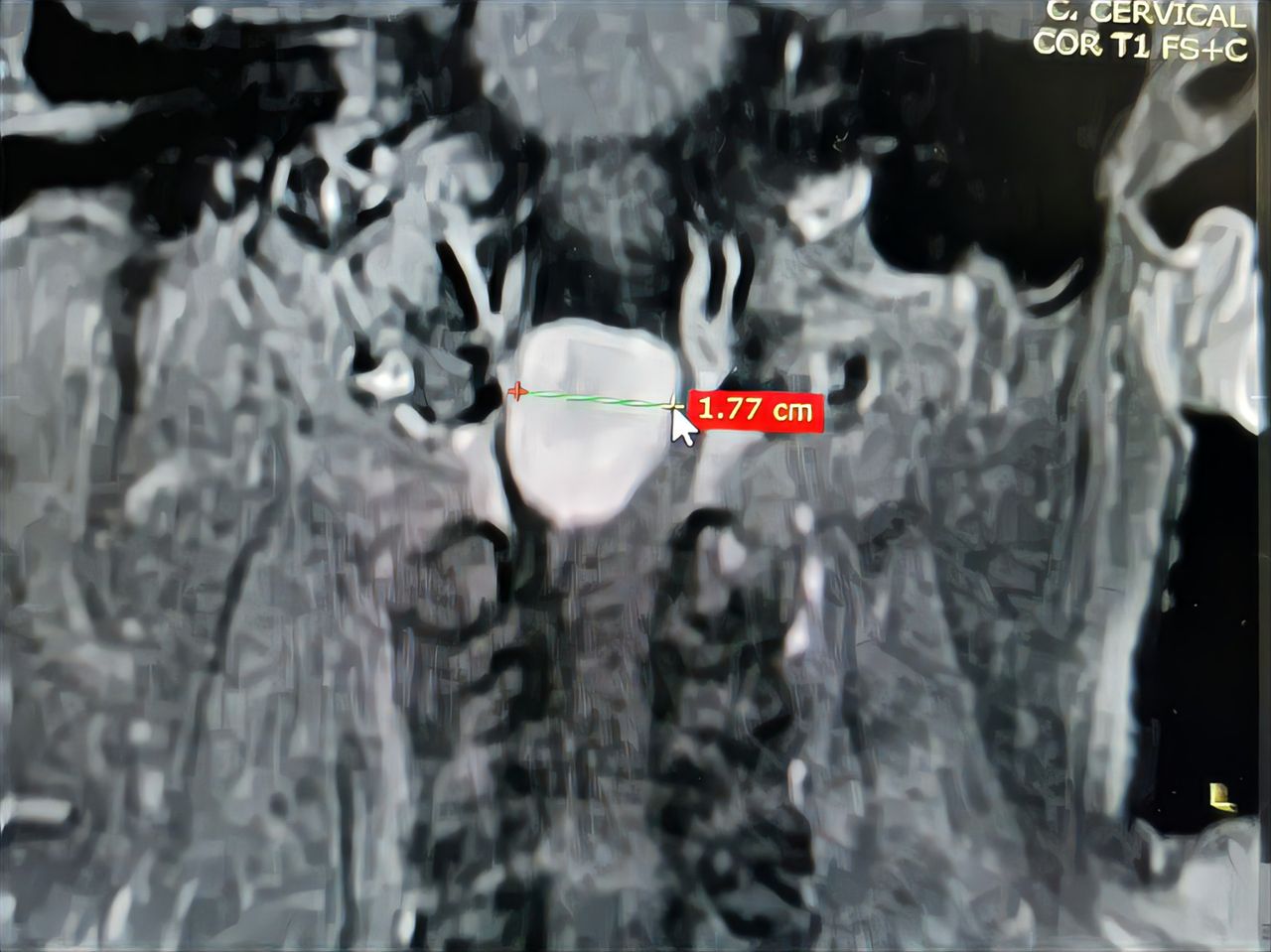 Gilraed Mota García-6