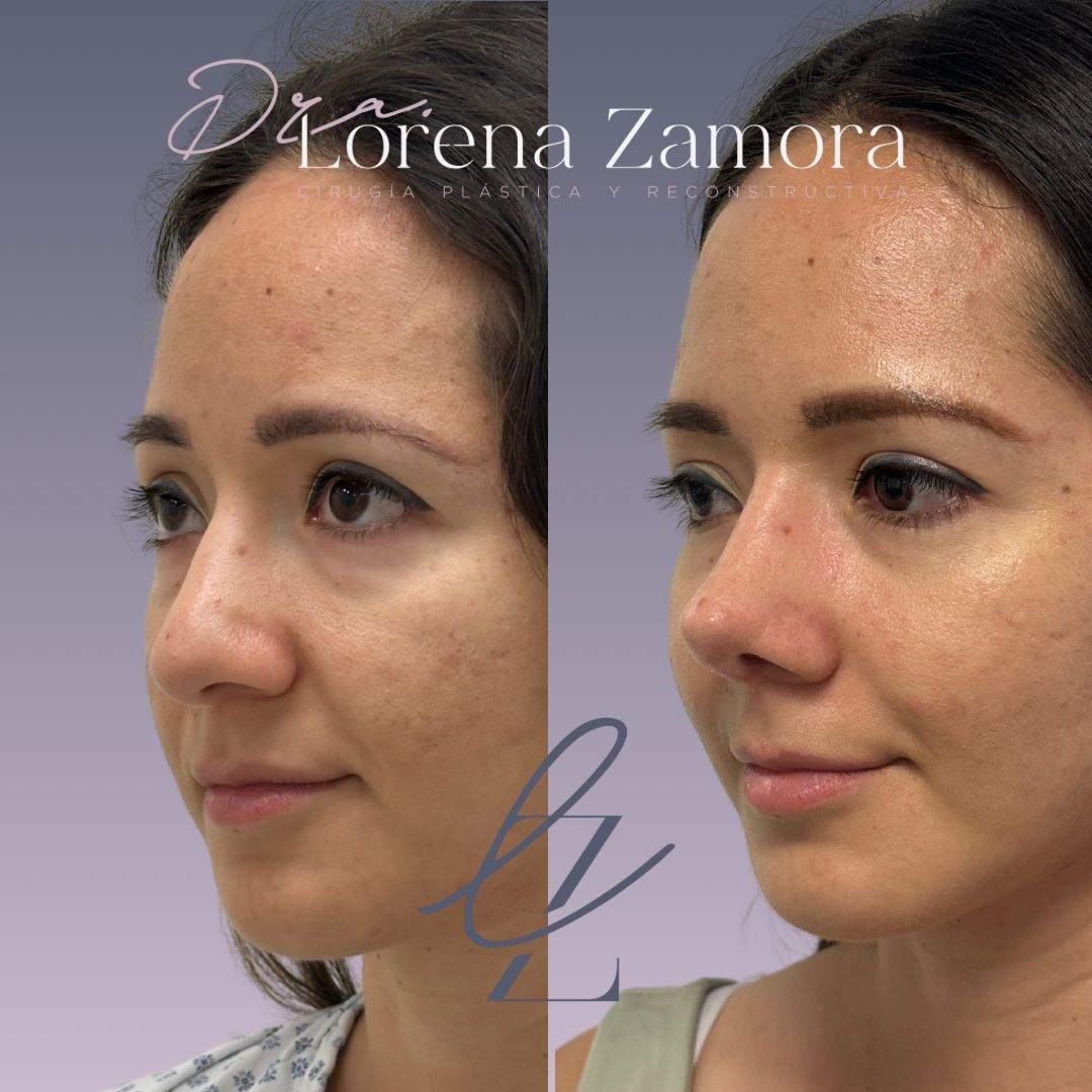 Lorena Zamora Pérez-1