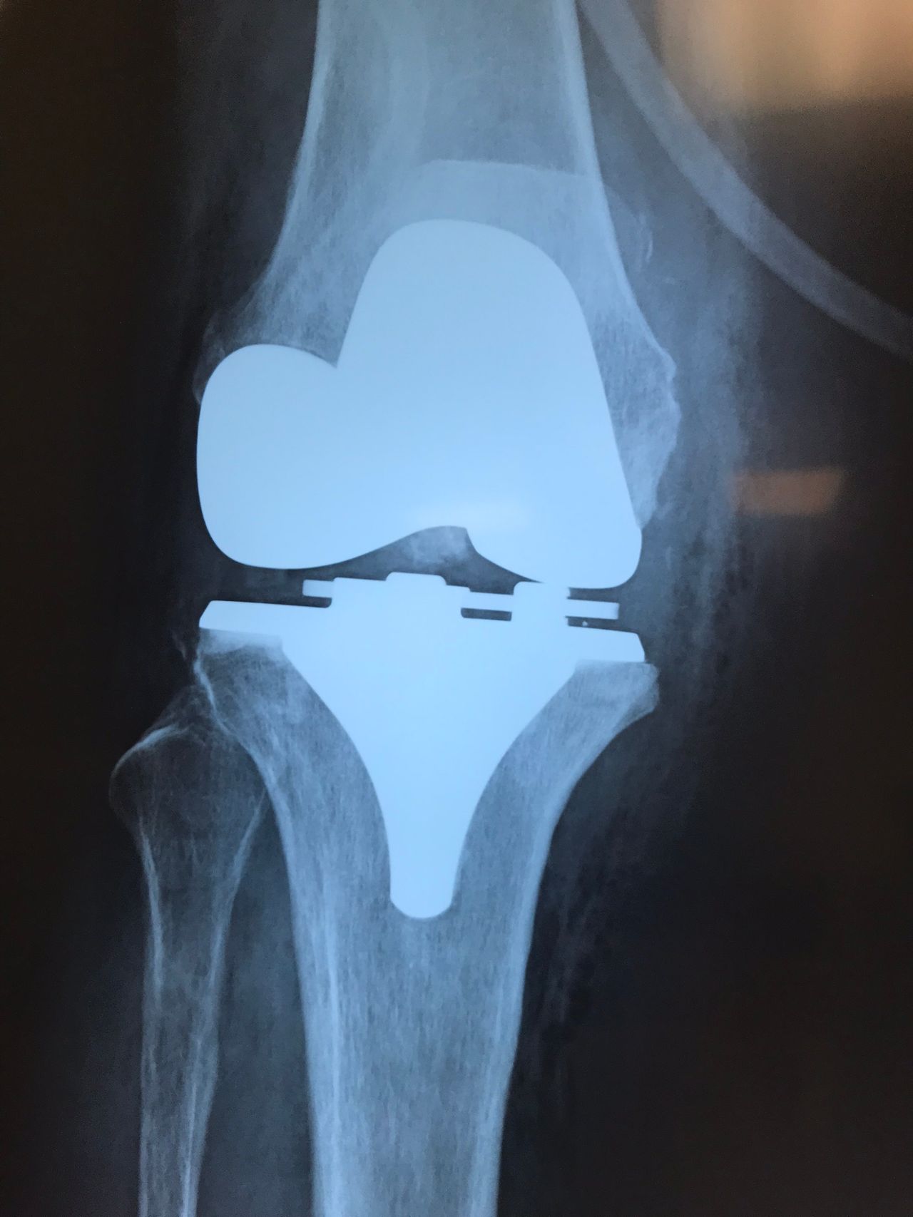 Carlos Alberto Romero Sosa-10