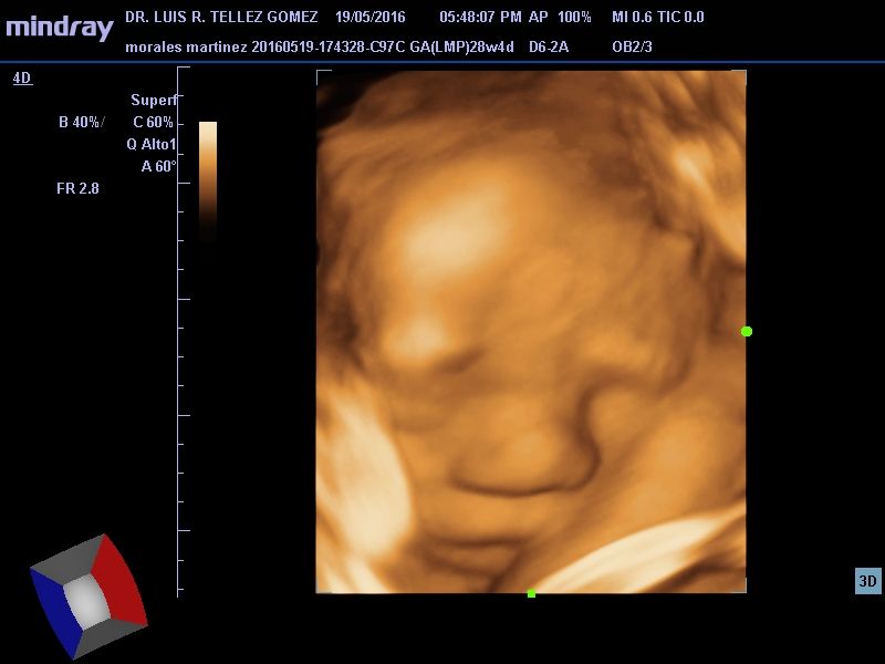 Luis Reynerio Téllez Gómez-5