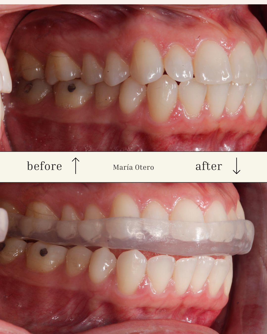 Maria Jesus Otero Lois-15