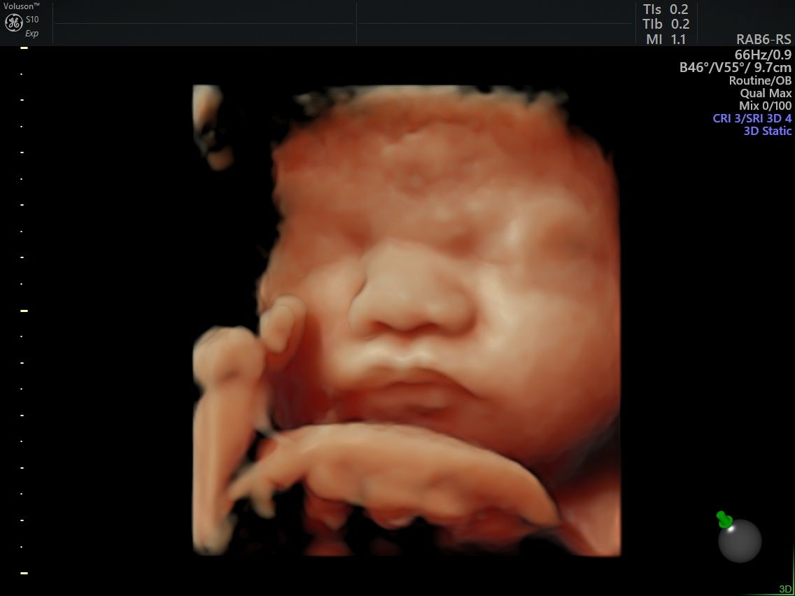 Arturo Herrera Flores-8