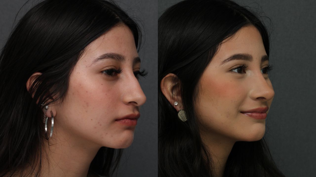 Angel Castro Urquizo-71