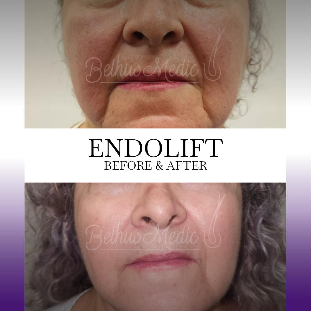 Alejandra Soriano Elorza-93