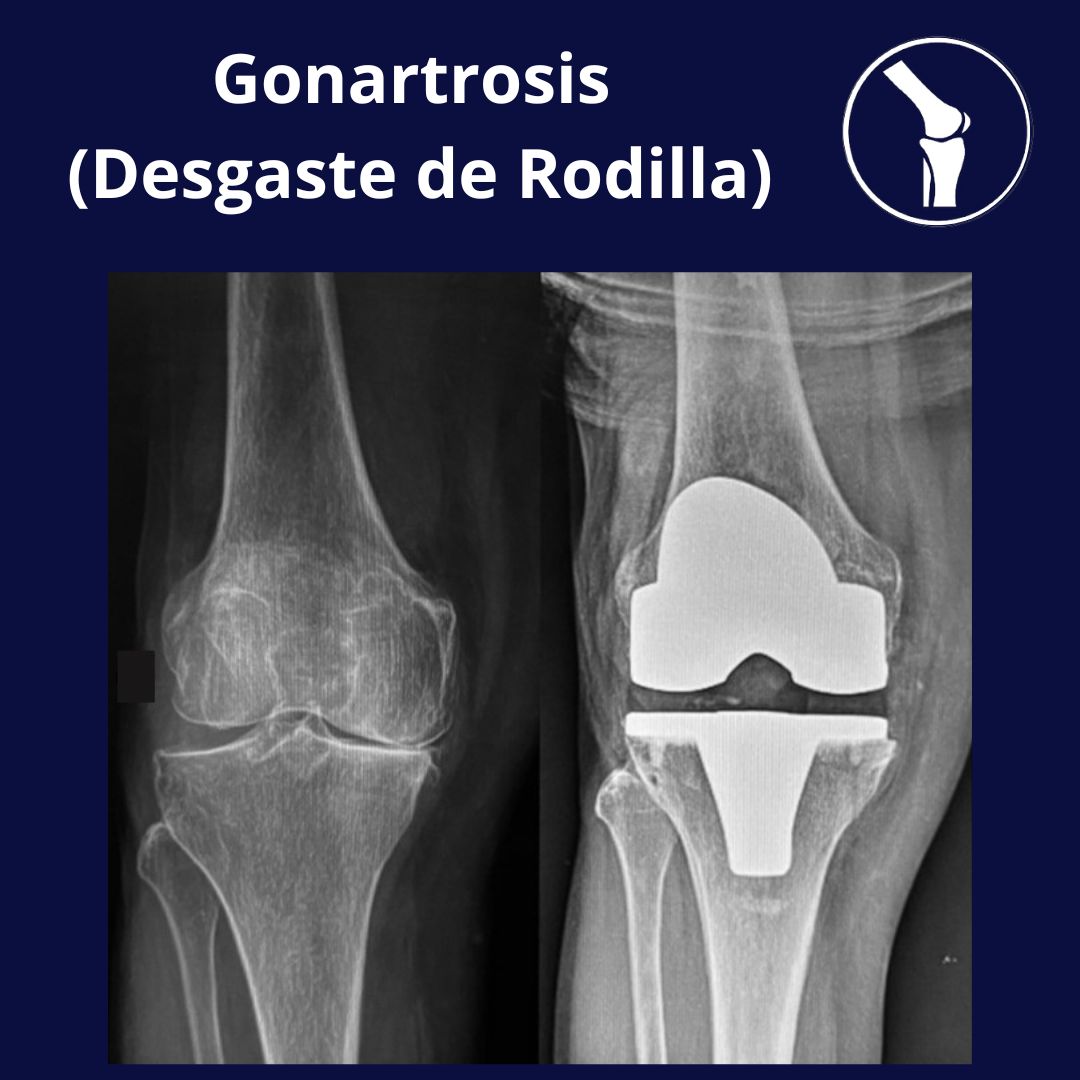 Daniel Garcia Velasco-3