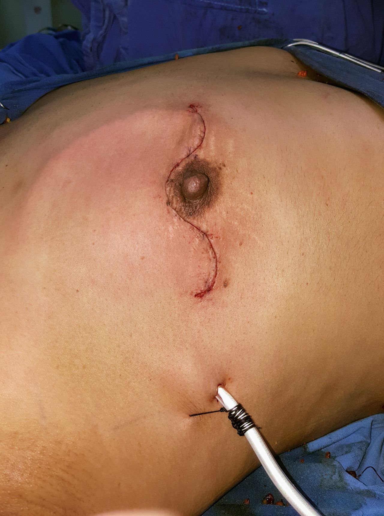 Ángel Millán Juárez-45