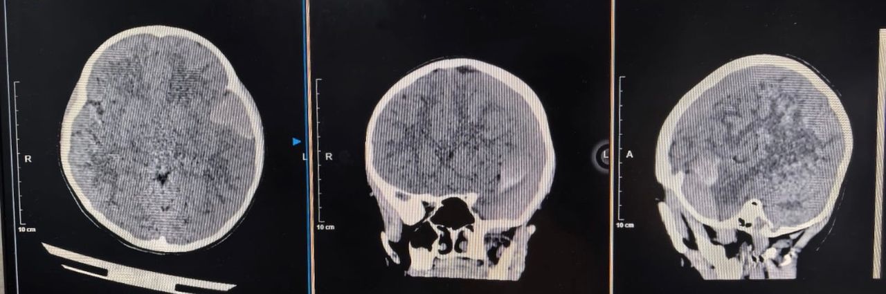 Alfredo Castro Ruiz-4