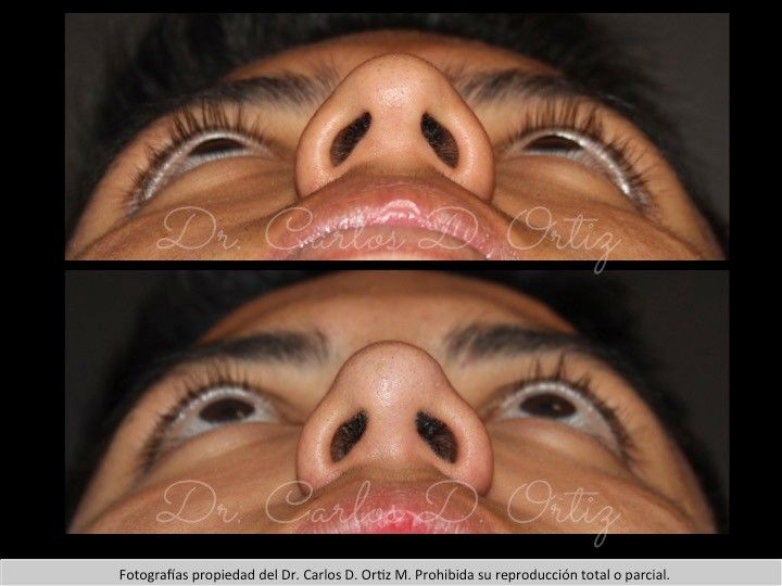 Carlos David Ortiz Moreno-10