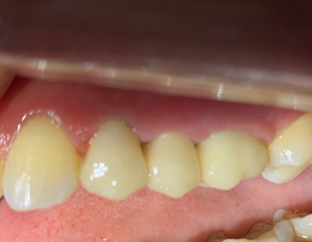 Yuriria Gochy Escalante-5