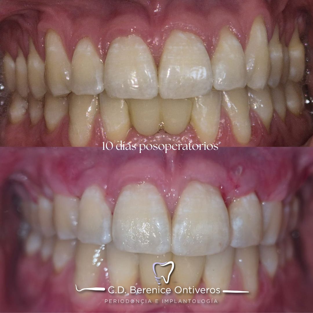 Berenice Ontiveros-9