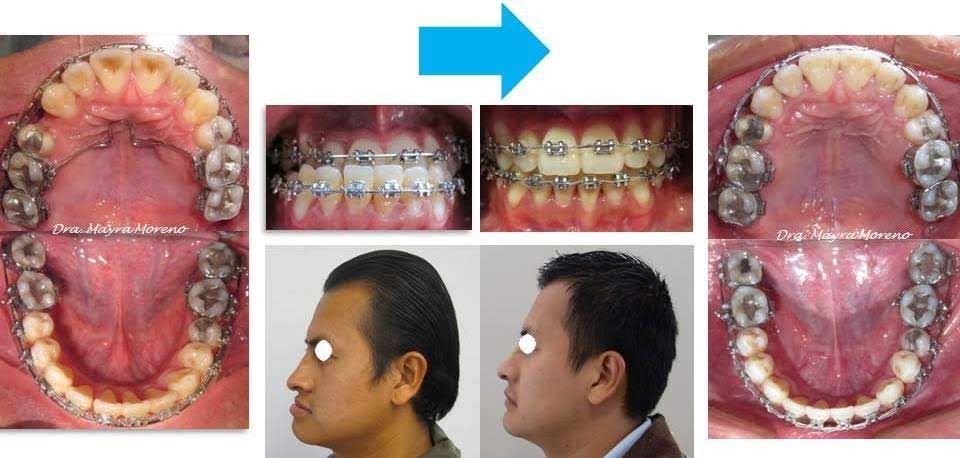 Mayra Moreno Rojas-11