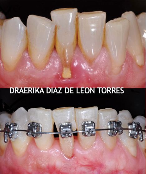 Erika Díaz De León Torres-18