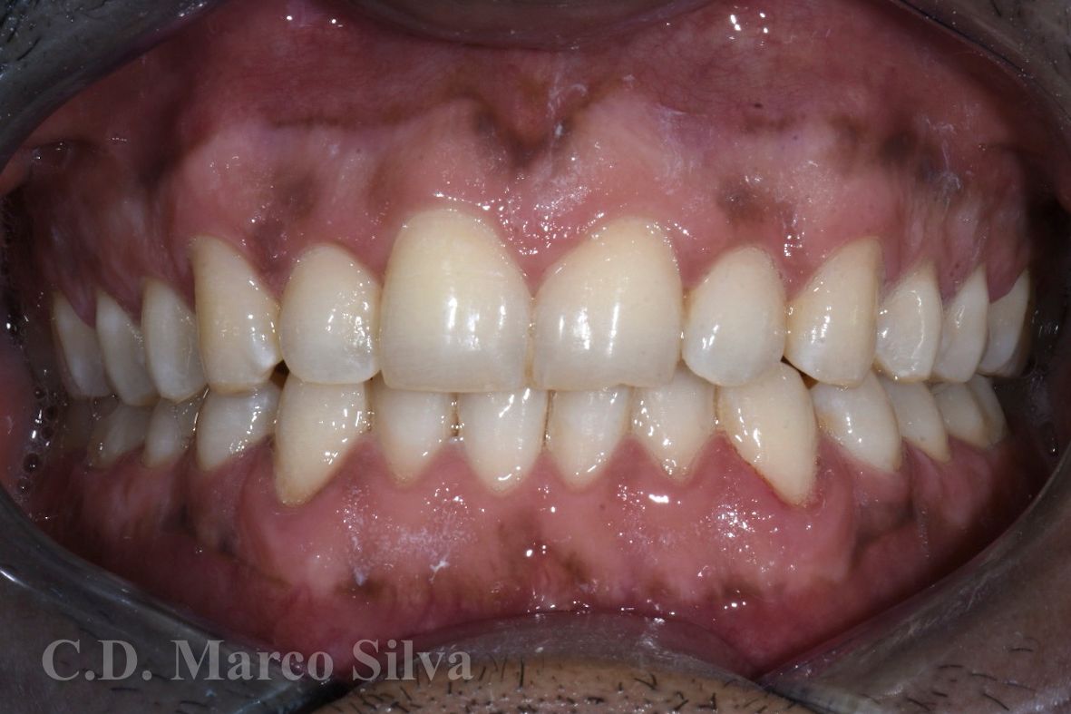 Marco Antonio Silva-12