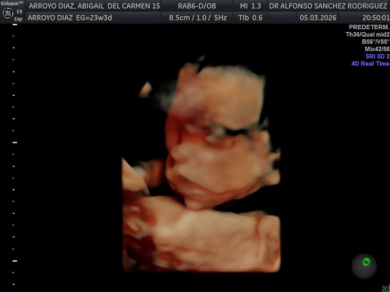 Alfonso Sanchez Rodriguez-54