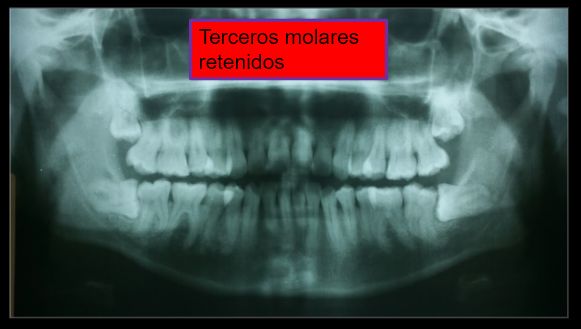 Diana Araceli Dávila Hernández-23