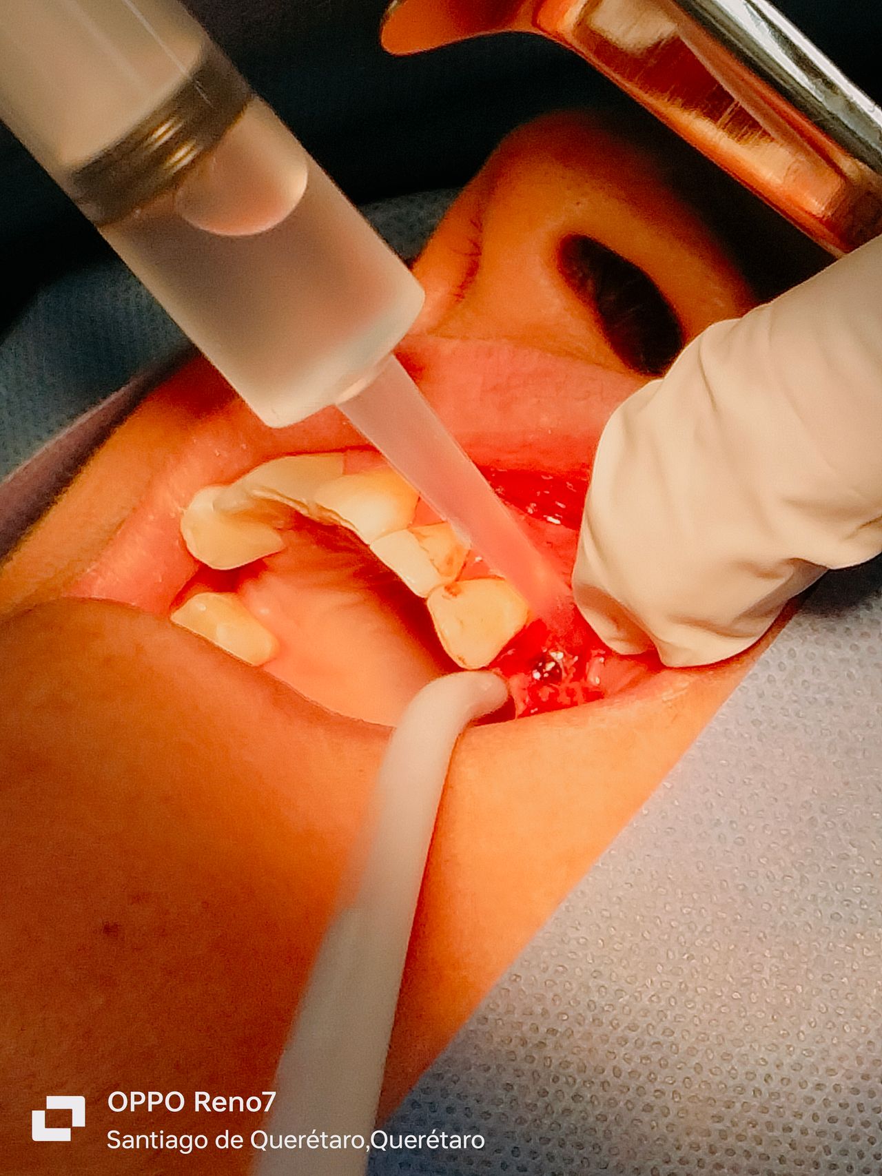 Yaneth Gutiérrez Sánchez-39