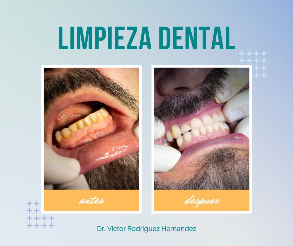 Victor Ramón Rodríguez Hernández-13