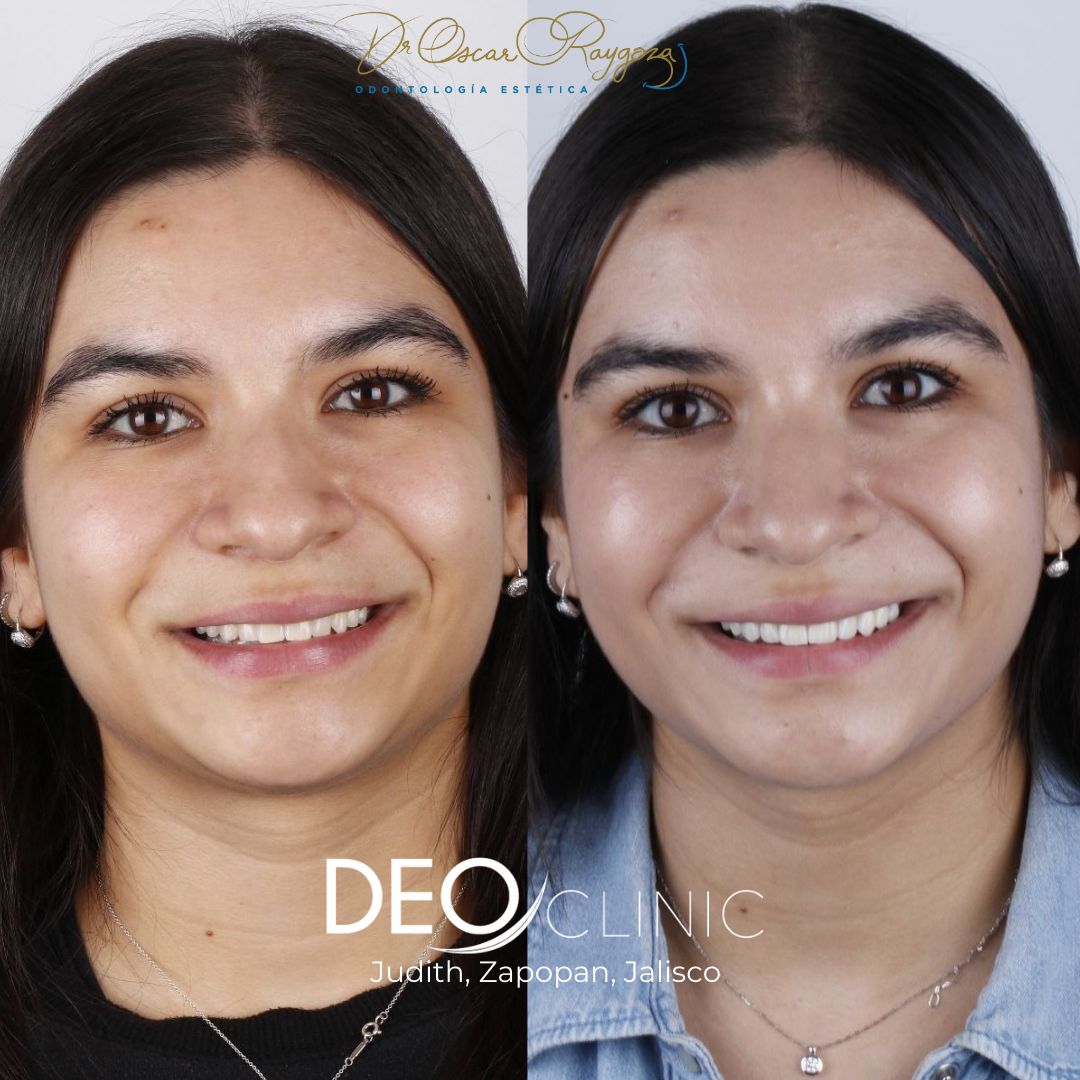 Oscar Raygoza Carrillo-19