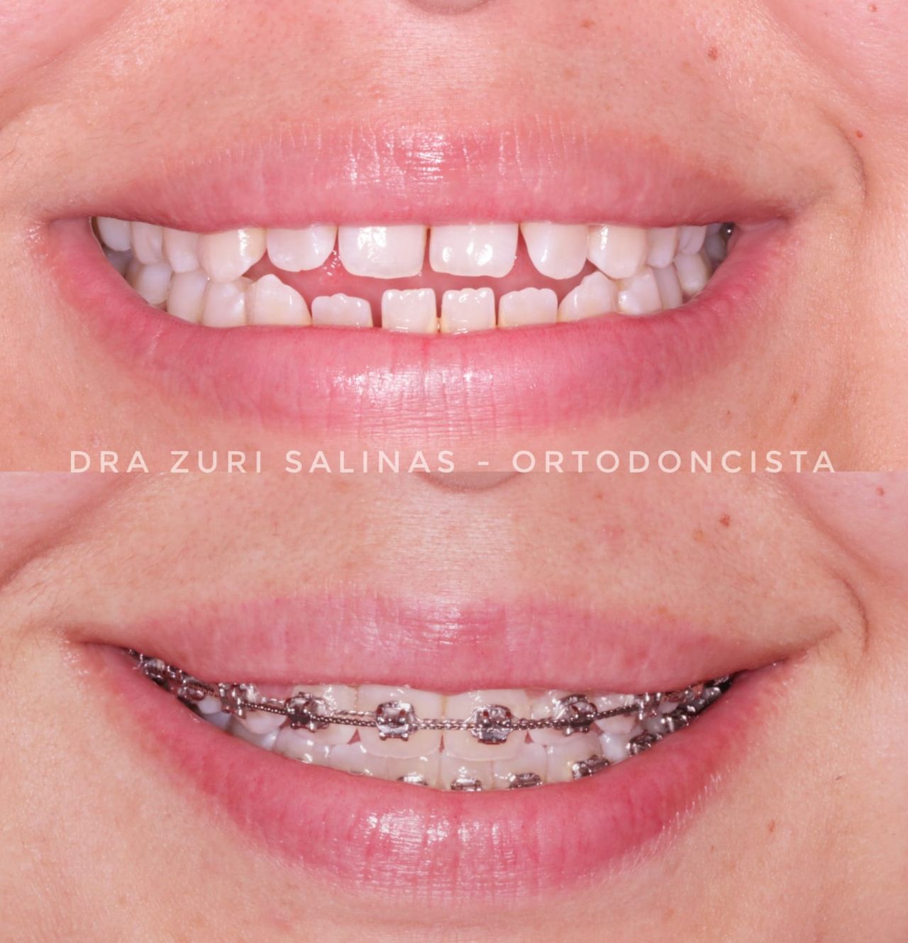 Zurisadai Salinas Chávez-11